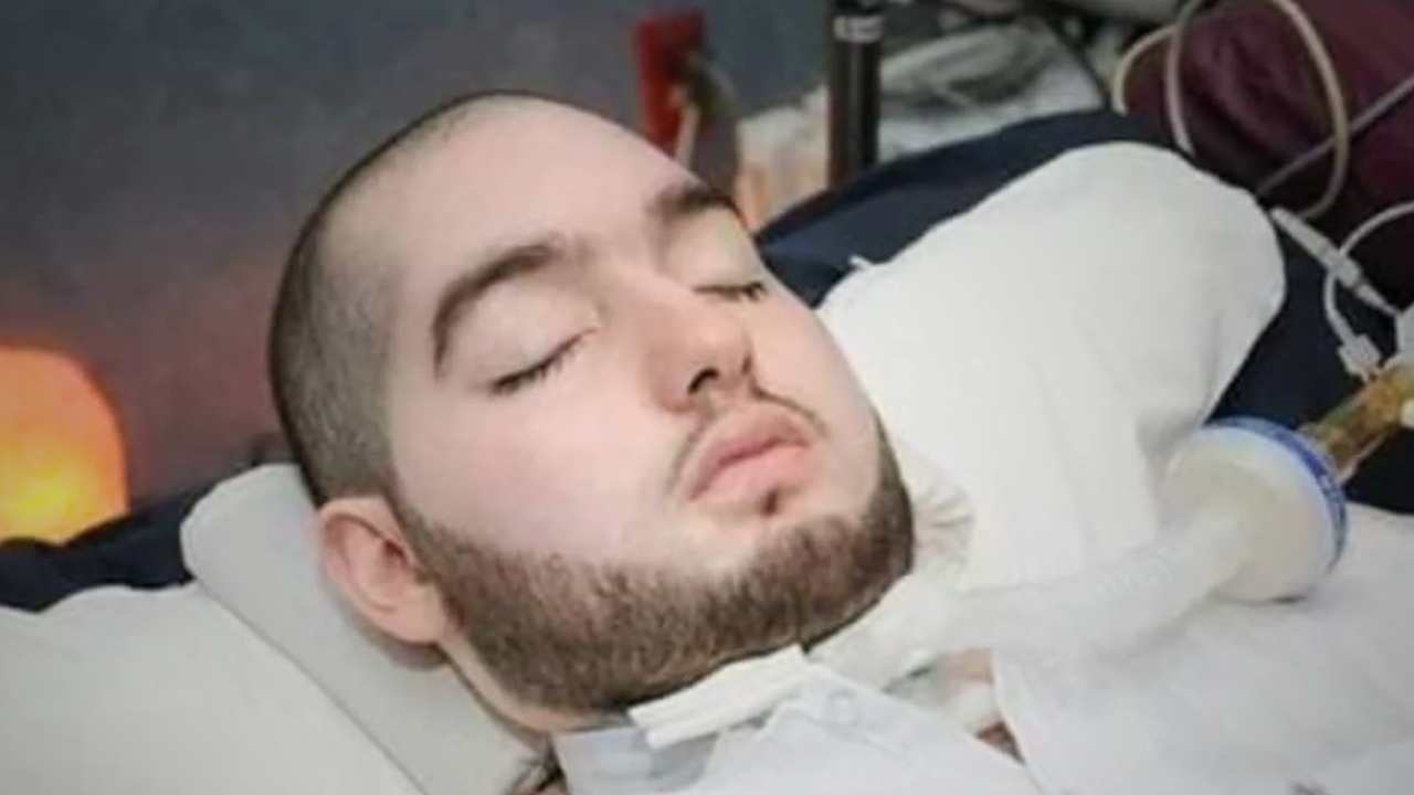 Sleeping Prince Death