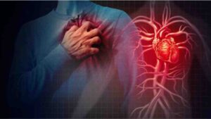 cardiac arrest