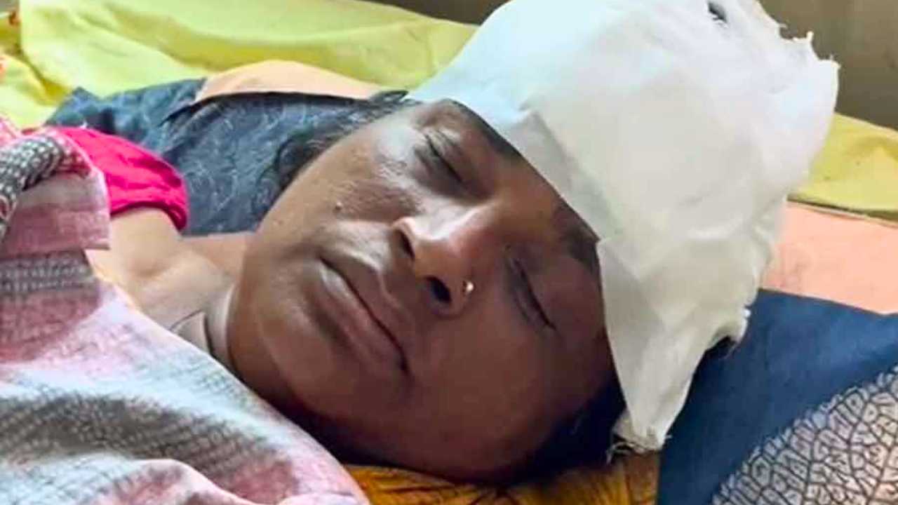 Drunk Man Attack On Nurse In Birbhum
