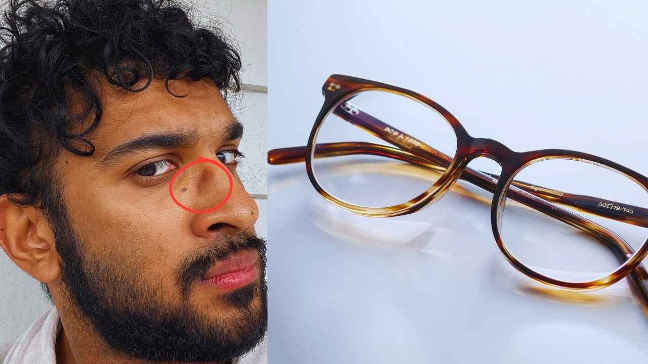 Spectacle Marks