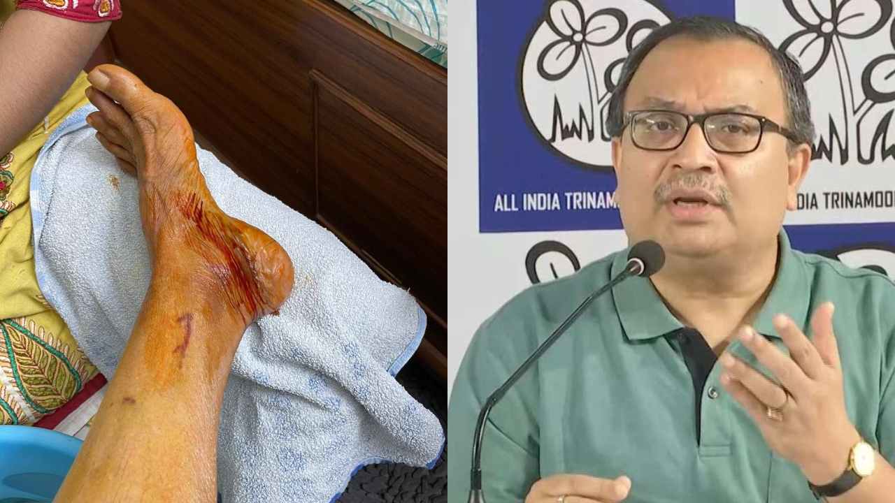 Kunal Ghosh on Mamata Banerjee's Injury